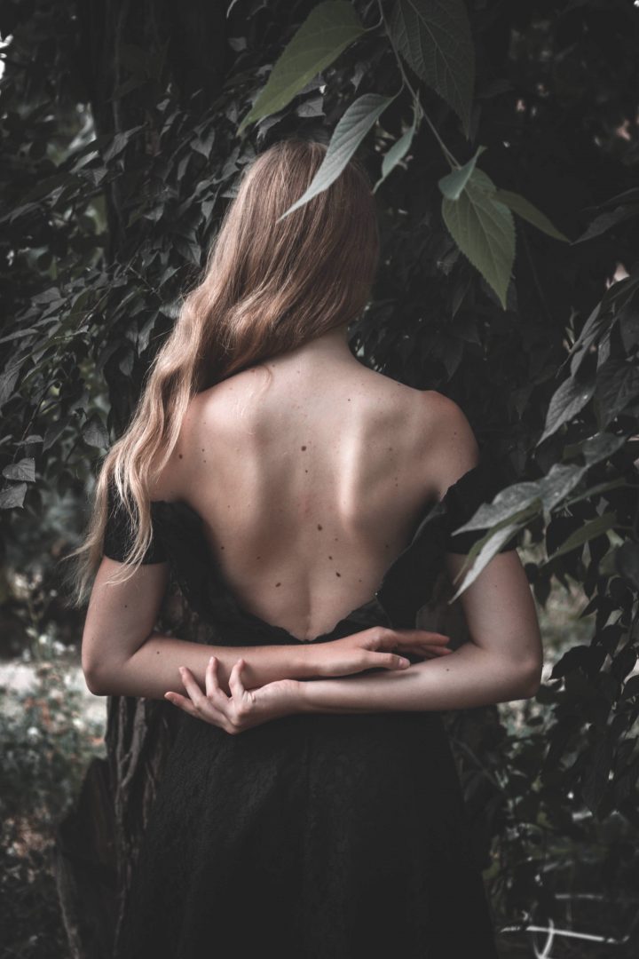 Sun’s Out, Moles Out: How To Keep An Eye On Your Moles This Summer