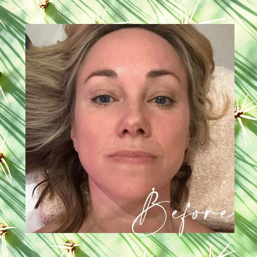 “This Beauty Treatment Is So Good It Made Me Cry”