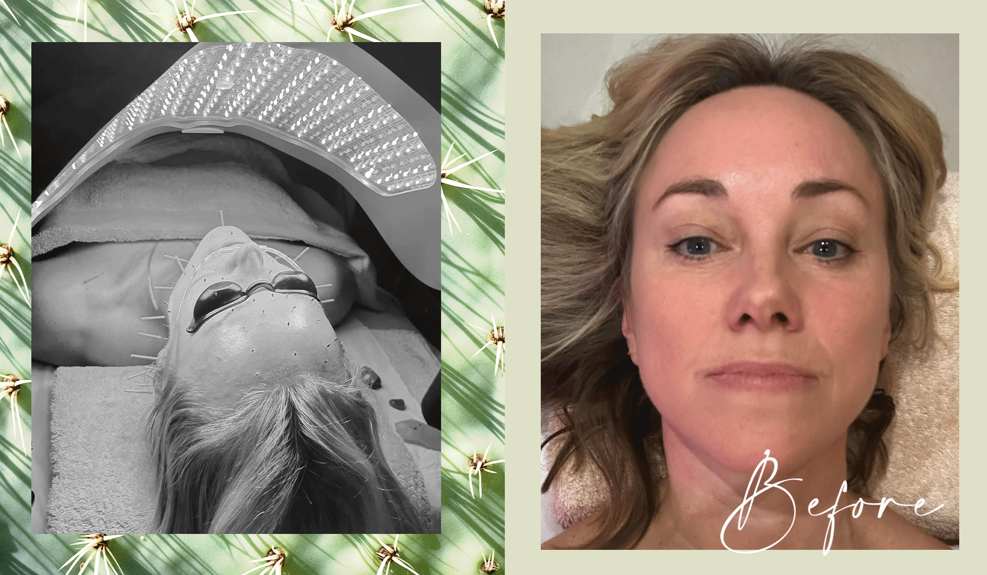 “This Beauty Treatment Is So Good It Made Me Cry”
