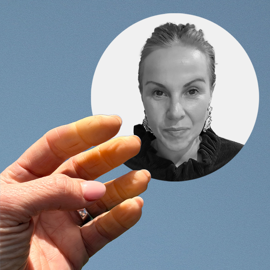 “What Living With Raynaud’s Has Taught Me About My Body”